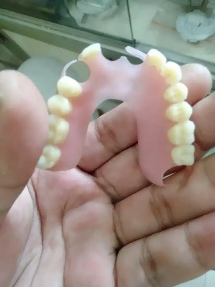 GIGI PALSU BONGKAR PASANG