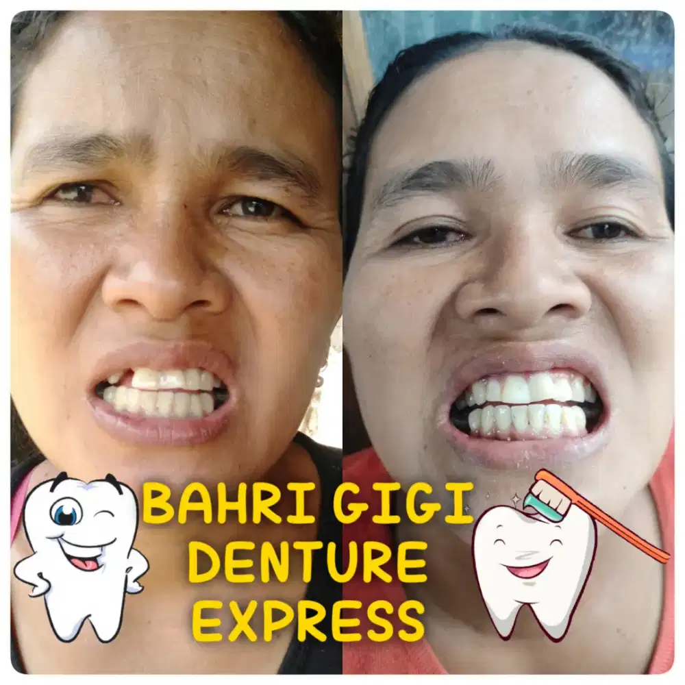 Pasang gigi palsu bergaransi terlaris