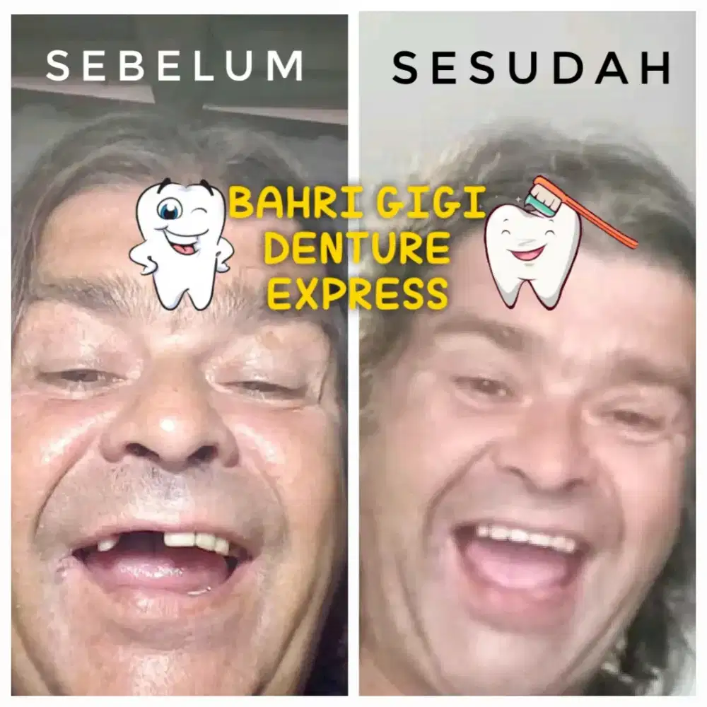 Pasang gigi palsu terjangkau termurah