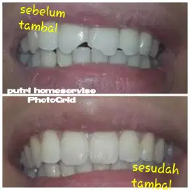 PERMANEN TAMBAL