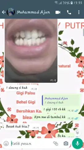 Testimoni tambal gigi