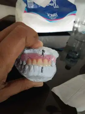 PASANG GIGI DAN SERVIS GIGI GIGI PATAH