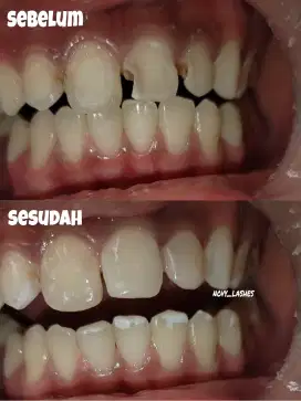 Ahli gigi / venner gigi palsu dll