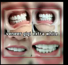 Venner gigi extra white