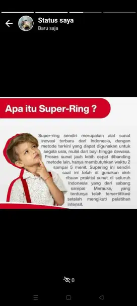 Sunat khitan Super Ring khusus anak-anak usia SD