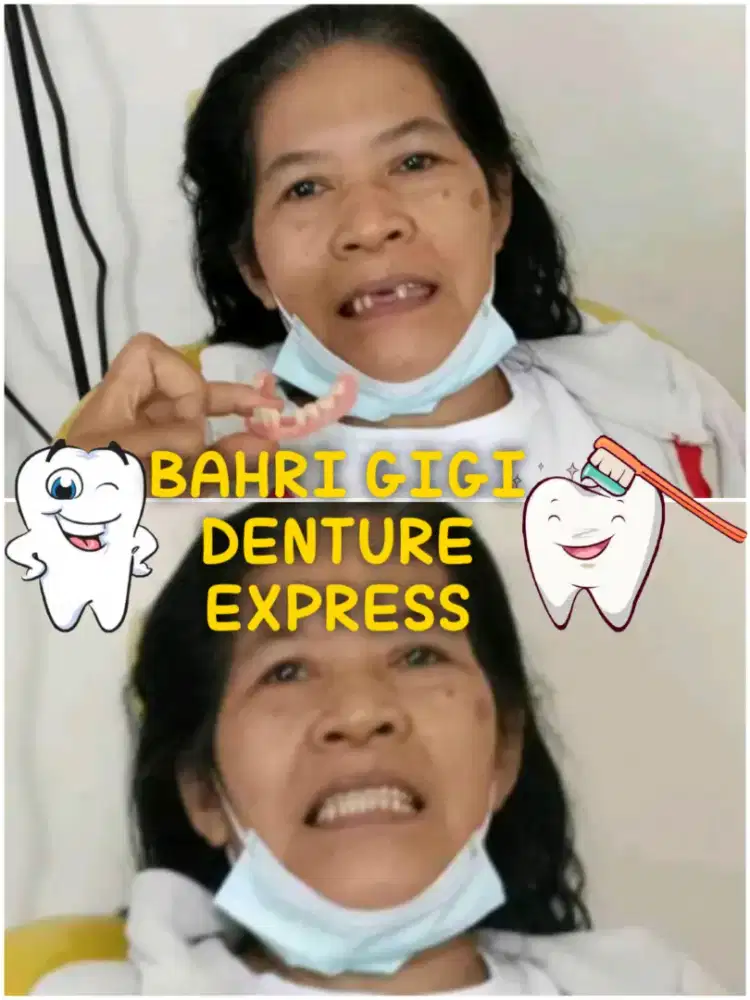 Pasang gigi palsu bergaransi termurah